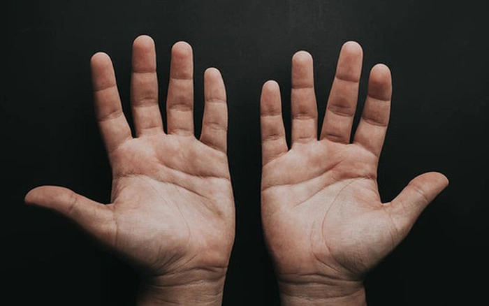 🦠 BỆNH TAY CHÂN MIỆNG ĐANG GIA TĂNG: CHA MẸ CẦN LÀM GÌ ĐỂ BẢO VỆ CON?